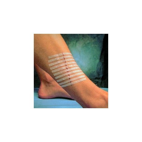 SUTURES 3M STERI STRIP 75x6mm -ROUGE-BOITE 50 SACHETS STERILES DE 3 VENDU PAR 4 BOITES